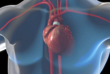 Ejection Fraction (EF): How It Affects People with Mitral Valve Prolapse