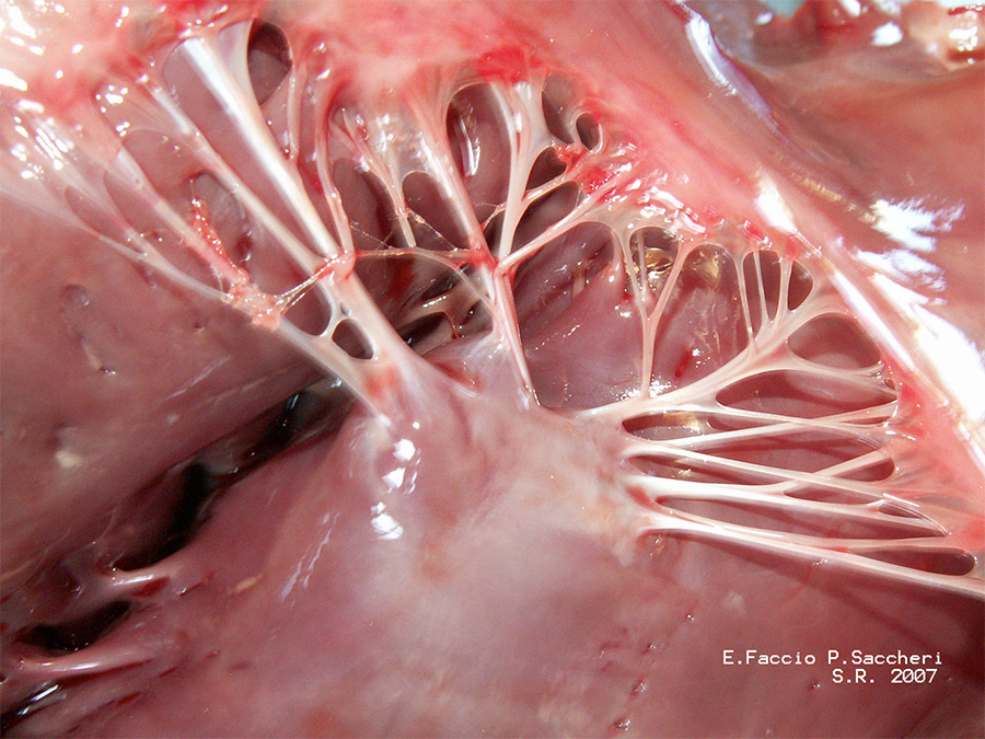 Chordae tendineae inside your heart